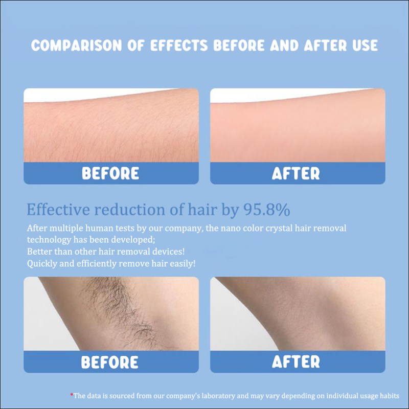 rnt-784 crystal nano hair removal file