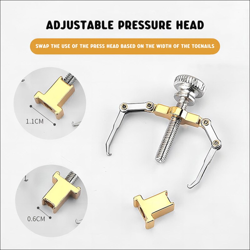 rnt-781 nail orthodontic device